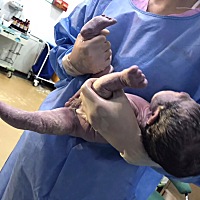 女宝一枚，儿女双全！ 真是全程超快，甚至都没有感受到几次宫缩。 顺产真的超快恢复，