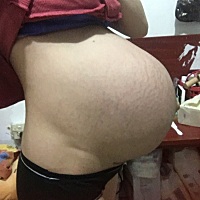 生了，女孩，报喜来的有点晚，所有症状都不准，生了最准，祝宝妈们心想事成，要啥来啥😄