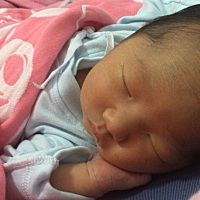 黄胆13.多，能怎么办吗?