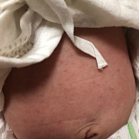 有没有人知道宝宝肚子上面是怎么回事啊 a