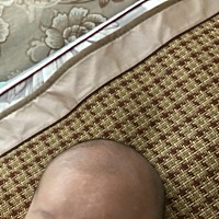 请问有没有宝妈知道这是怎么了？