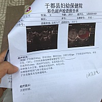 产后42天体检，发现子宫恢复不好：子宫偏大纵径68×厚径46×横径52mm，宫腔分离4mm，宫颈厚29mm，宫腔积...