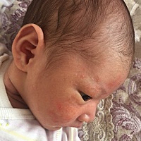 各位宝妈们，宝宝脸上长了红疹子，有类似经历的吗？怎么能退下去，求推荐