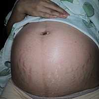 这个肚皮花纹，低腰的裤子以后都不能穿了。