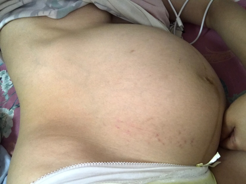 怀孕37周的肚子