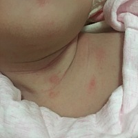 请问这个这么大还会破皮流点水然后变得驺吧吧的是什么？奶藓？