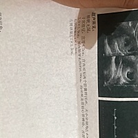 七月底用试纸测的两条杠。上个礼拜去验的血。有点出血，肚子疼。说今天再去验血做B超。验血结果没出来就...