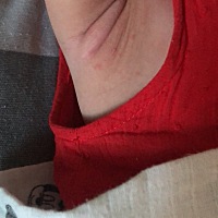谁家宝宝出过幼儿急疹。是什么症状，一个多月前我闺女反复发烧四五天没有出疹子，昨天晚上三点多又开始...