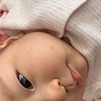 这是湿疹吗？这是什么？