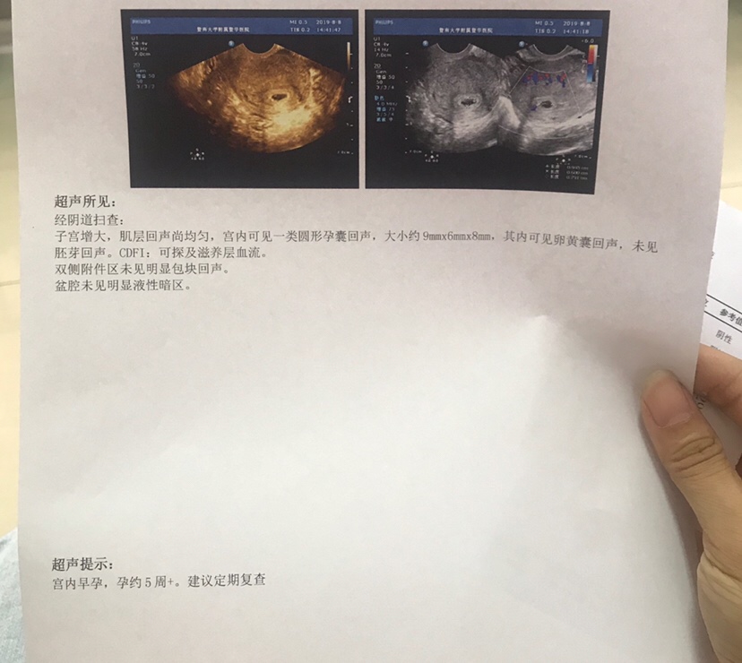 八月8号检查结果
