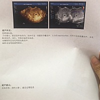 八月8号检查结果