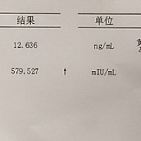 咨询下大家这是什么意思，有点懵