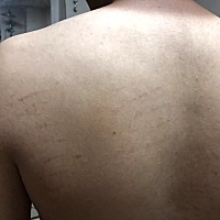 姐妹们帮我看一下 这是抓痕吗 这两天我老公老是半夜才回家 ，我怀疑他在外面胡搞 帮我看看