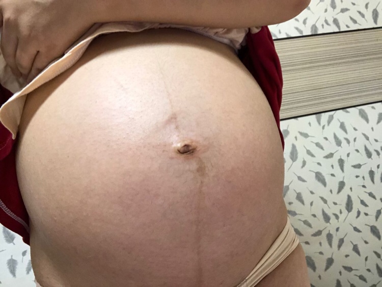 肚形状像男孩还是女孩……没检查不知道……