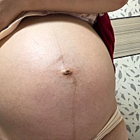 肚形状像男孩还是女孩……没检查不知道……