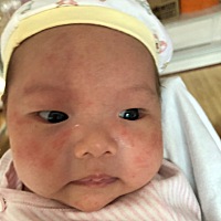 2个月脸上长红疹，还会传染其他地方，有什么药吗