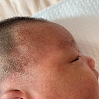 各位宝妈帮我看一下这个是痱子还说湿疹？