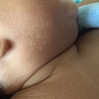 请问宝妈们这是什么啊 好担心