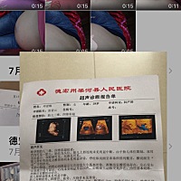 亲，帮我看看我这是怀的男孩还是女孩，只是好奇而已。我没有重男轻女哦，我预产期是下个月生了、这个是...