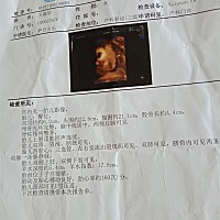 孕妈们你们看看我的四维彩超有什么不同吗？看不见宝宝的脸和心脏我有点着急，还脐带绕颈一周