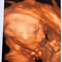 从四维到出生到现在，越长越开了哟，哈哈哈。四维拍的怎么不像呢，高鼻子哪去了？😓