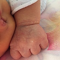 宝妈们 麻烦帮我看一下我家宝宝手上是什么qim