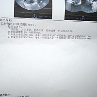我不是多囊，试纸显示今天强阳，但这个月又备孕失败，16号去监测无优势卵泡，又过了两天，不知道会不会...