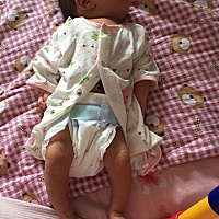 七夕宝宝，出生13天，睡觉总喜欢把腿蜷着，感觉小腿有点螺旋腿，正常吗？