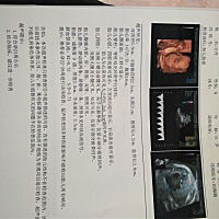 四维通过  不知道是男孩还是女孩 有清楚的宝妈？(ღ˘⌣˘ღ)