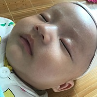 脸上的小碎米是痱子还是啥东西？有没有知道的宝妈