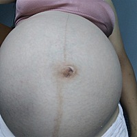 感觉肚子像个大皮球一样，还好整个孕期无孕吐，马上快卸货了，也没有长妊娠纹，只是最近很难受，老...