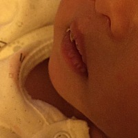 宝宝13天了，嘴起皮怎么回事？有没有类似情况的？