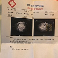 亲们，我7月10号末次月经，到今天怀孕41天了，为什么B超显示才4周？