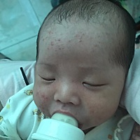 各位宝妈们 帮我看看这个是怎么了 是湿疹吗？今天出生二十天