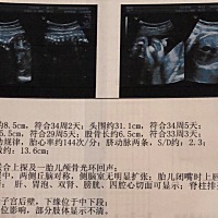 各位宝妈31+6数据正常吗 腹围数据小吗 都不知道该多吃还是控制了