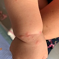 有谁知道这一颗颗的是啥玩意？