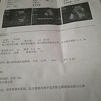 刚去做检查，做完后问了下男孩还是女孩，最后被告知是男孩，大宝儿子，二宝想要个女儿，希望儿女双全，...