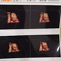 大家帮我看下，这是做的四维单子，看能不能看出男女