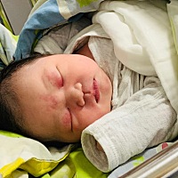 8.19刨宫产一枚佩奇，提前两天入院待产，在这里建议宝妈尽量还是选择单人房，因为刨宫产我出来基本都是...