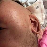 宝宝脸上这是长了啥子东西？