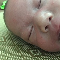 宝妈们 宝宝脸上那些白点是什么来的啊 总是反反复复的好了又有