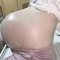 1+1=4 两个小千金 4.3， 4.4 没进保温箱，宝宝厉害 能吃能睡[呲牙]