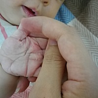 宝宝手会粘粘的，会粘毛毛，每天早晚都有给宝宝用湿毛巾擦手，今天发现小手掌居然脱皮，宝妈们知道这是...