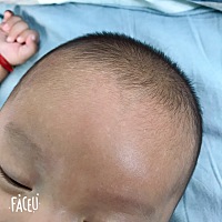 我家宝宝70天，额头上有好多白色的点点，也摸不出来，就是明显的能看见，不像痱子一样摸着凸起来