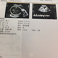 有会看男孩女孩的吗？好奇