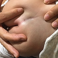 你们小孩屁股股沟有凹进去一个洞吗，扒开的话没有洞，是皮肤