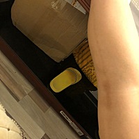 有得过产后血栓的宝妈吗？你们是怎么治疗的呢 你们的症状是什么 我的症状是静脉曲张 血管变黑 这个病到...