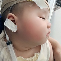宝宝两个月多的时候咳嗽一次，嗓子都哑了，这才过了一个多月，两个月都不到又咳嗽了，这次查直接肺炎了...