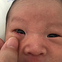 求助…宝宝眼睛下面长白点什么原因？？？