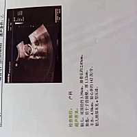 有会看单子的希望是个小棉袄